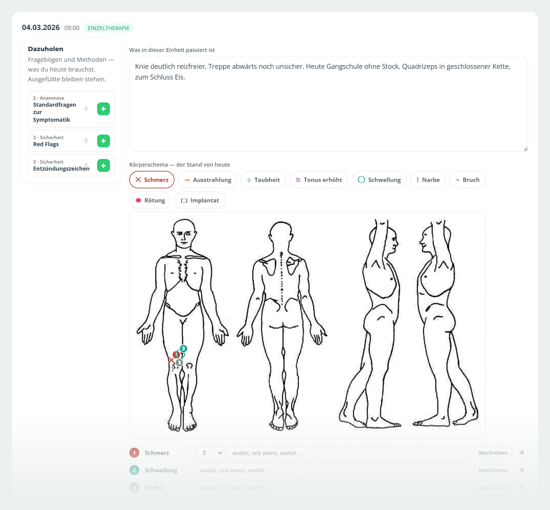 Eine Therapieeinheit in Vigorix: die Notiz zur Behandlung, das Körperschema mit drei Markierungen am rechten Knie und die Auswahl zum Dazuholen von Standardfragen, Red Flags und Entzündungszeichen.